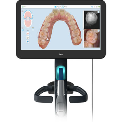 iTero Scanner